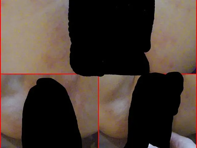 Reingespritzt-TOTAL PRIVAT